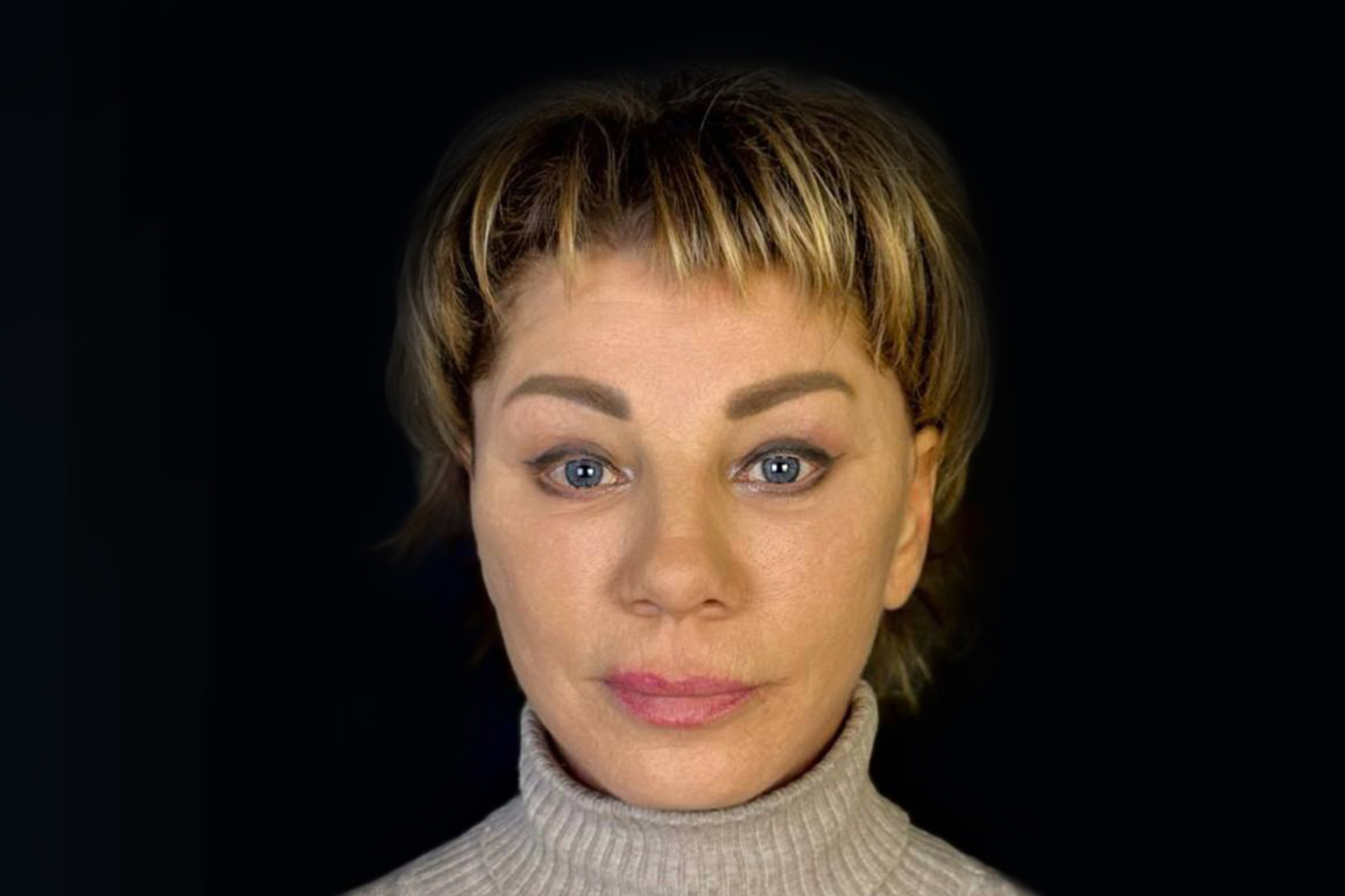 Классический лифтинг лица