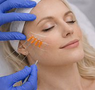 Лифтинг нитями Груздев Тренд (GRUZDEV TREND)